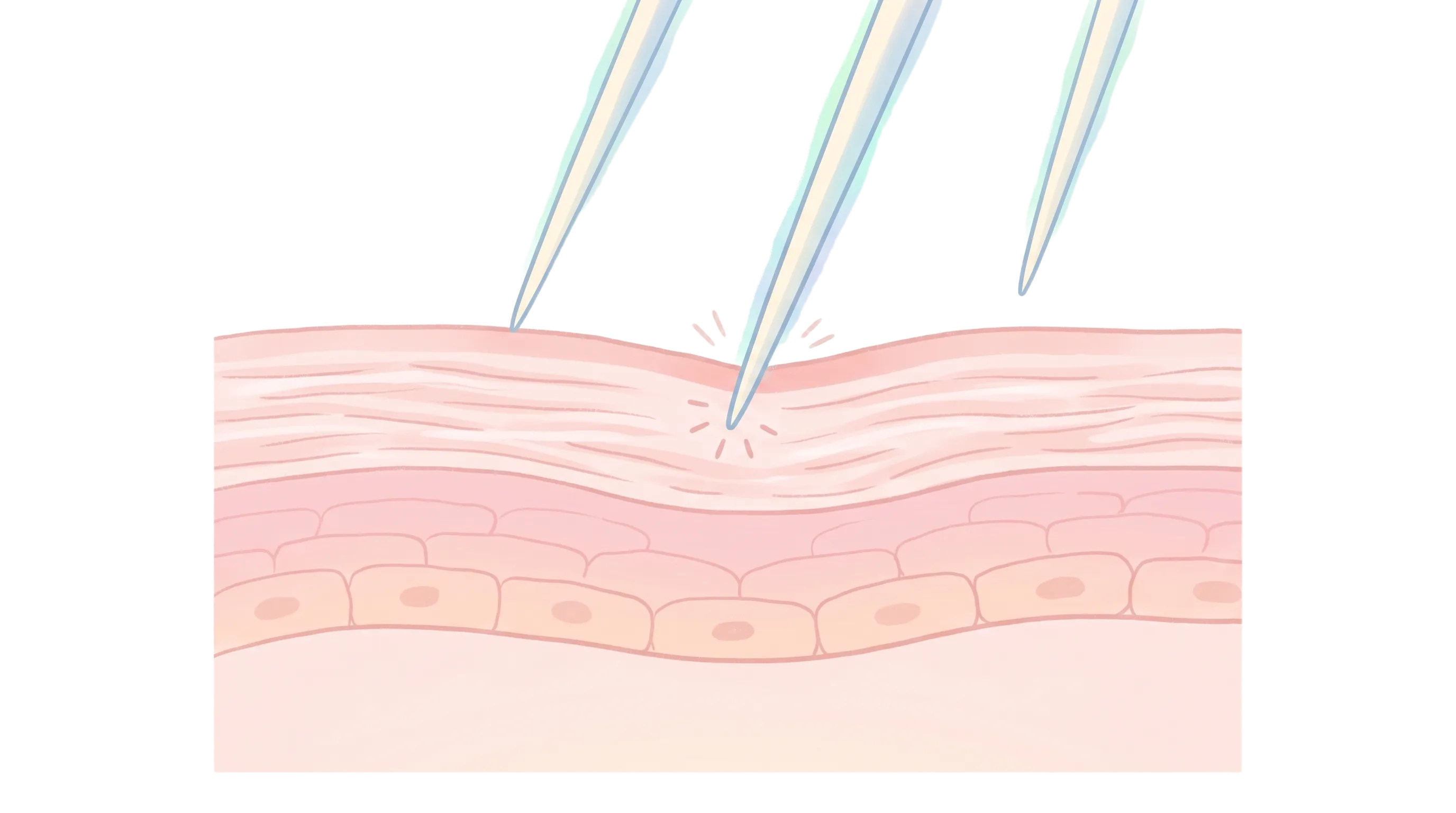 刺さる